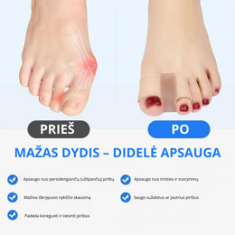 Pirštų separatorius komfortui ir nykščio padėčiai
